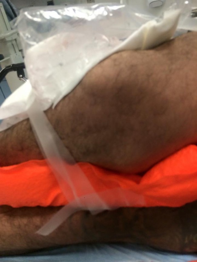 That Knee doesn't look healthy